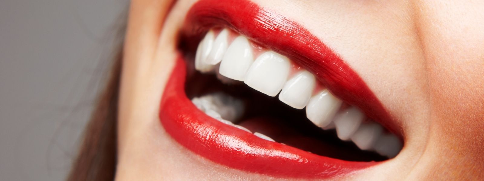 Girl with red lips and white teeth smiling.